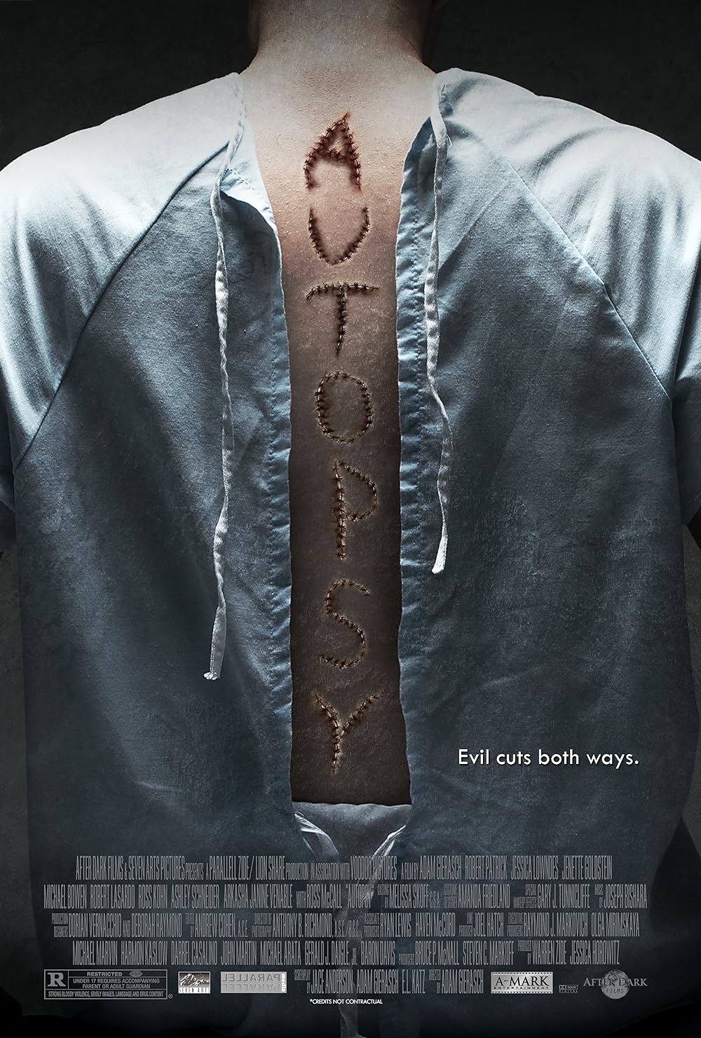 Autopsy 
