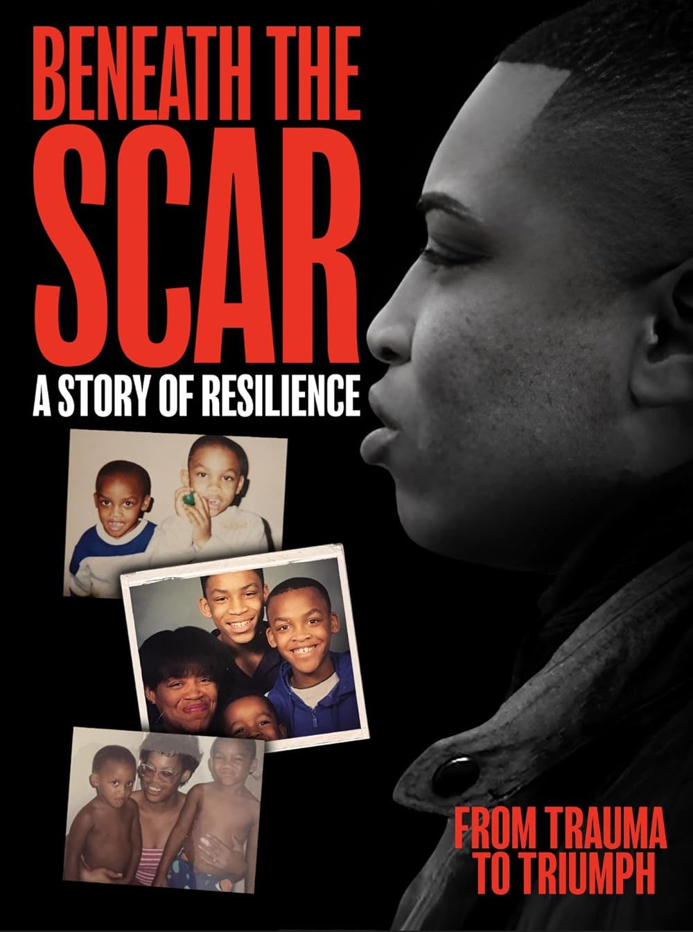 Beneath the Scar: A Story of Resilience 