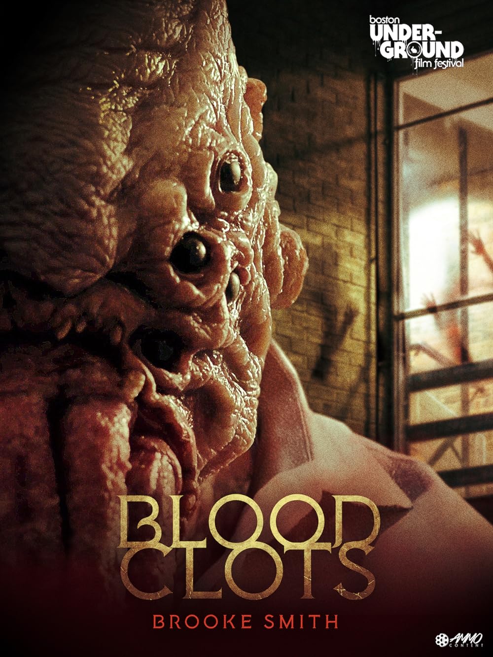 Blood Clots 