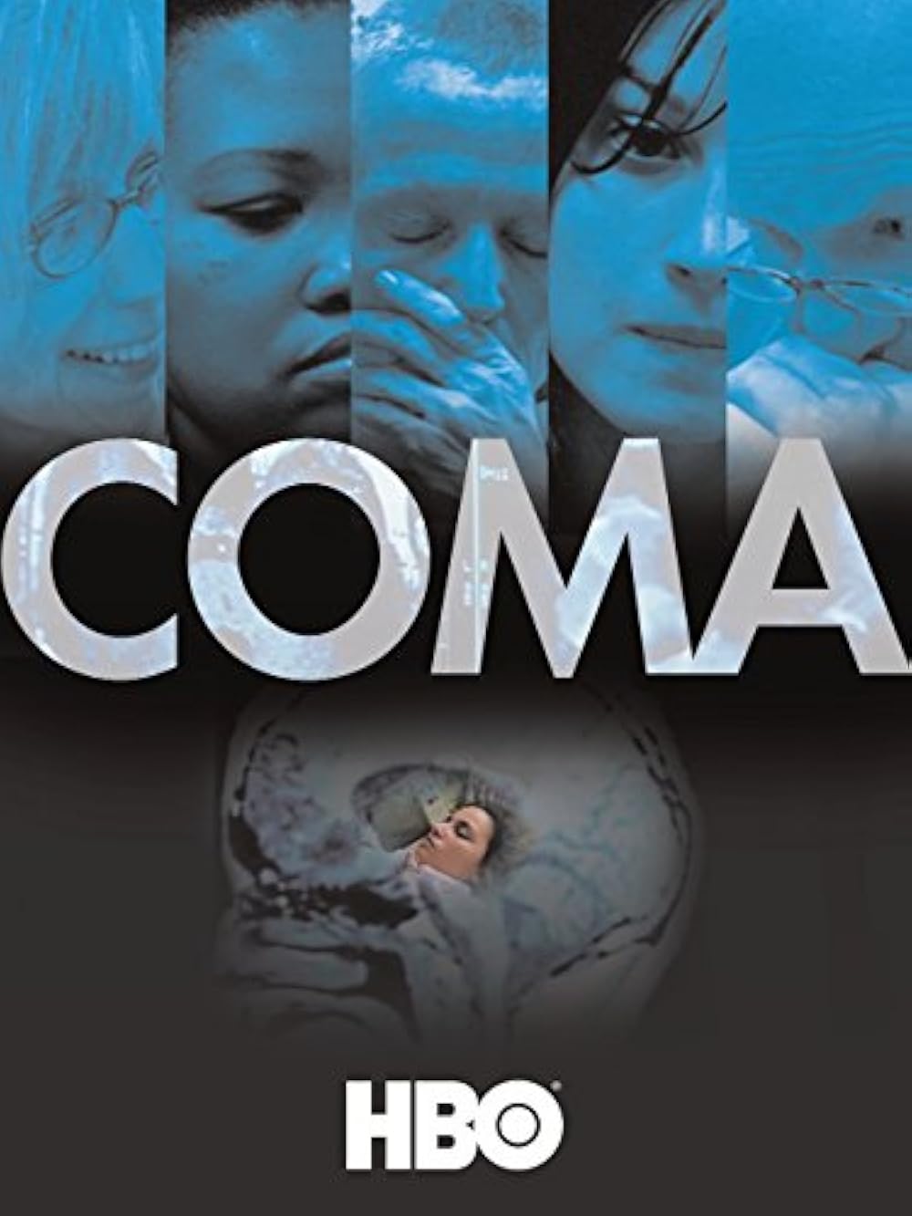 Coma 