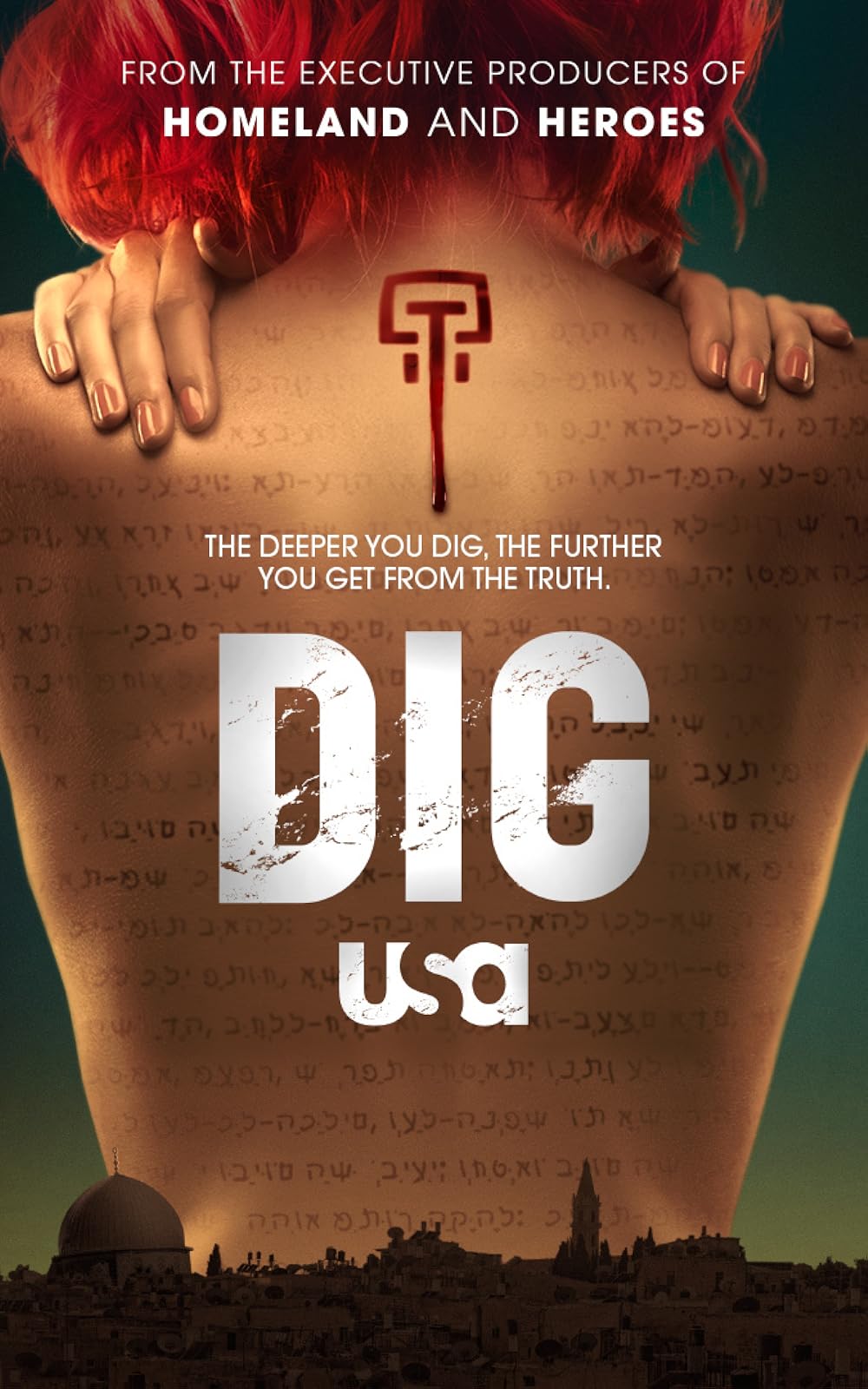 Dig 