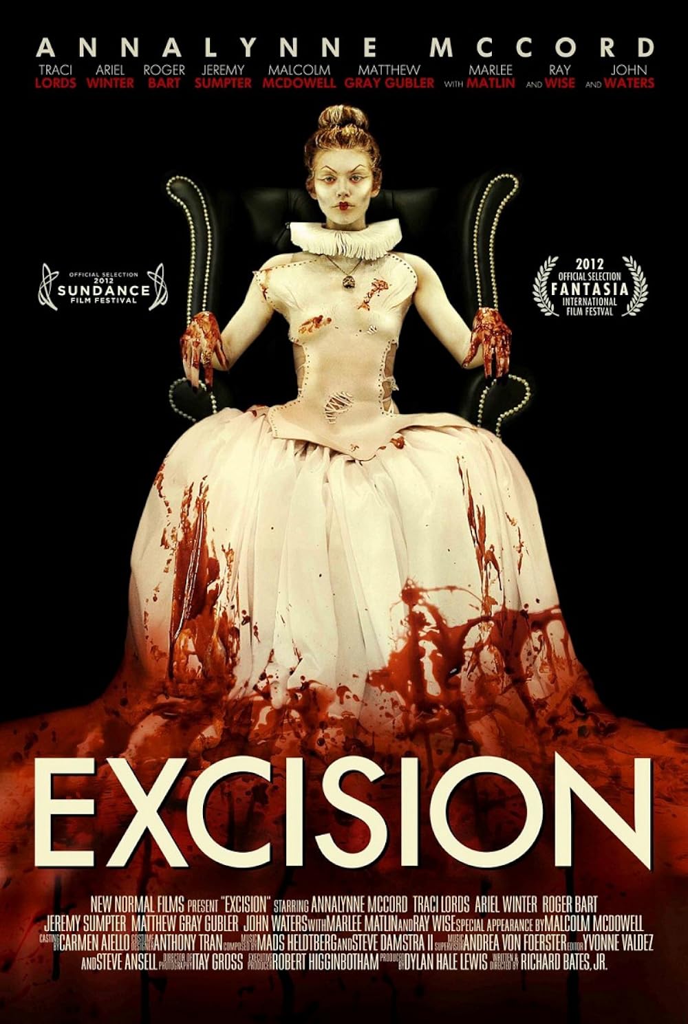 Excision 