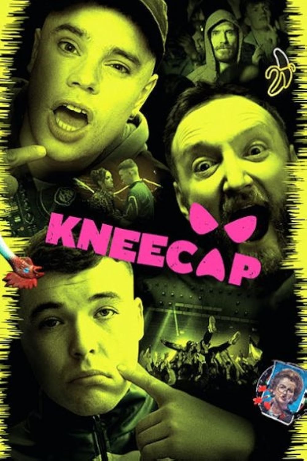 Kneecap 