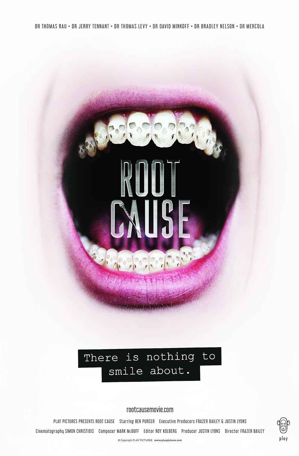 Root Cause 