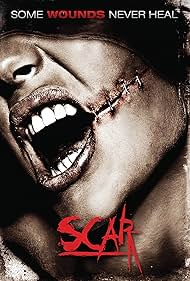 Scar 