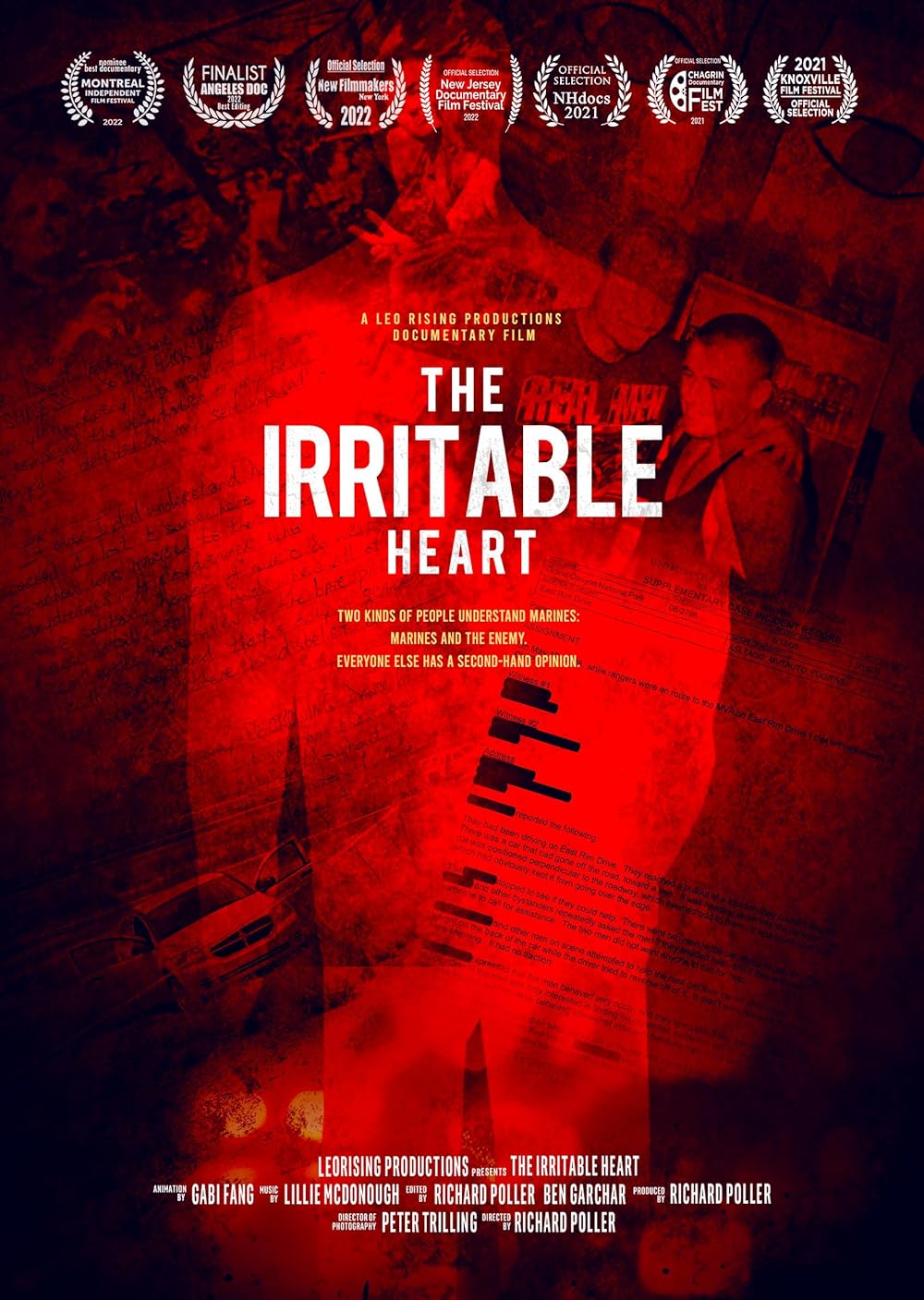 The Irritable Heart 
