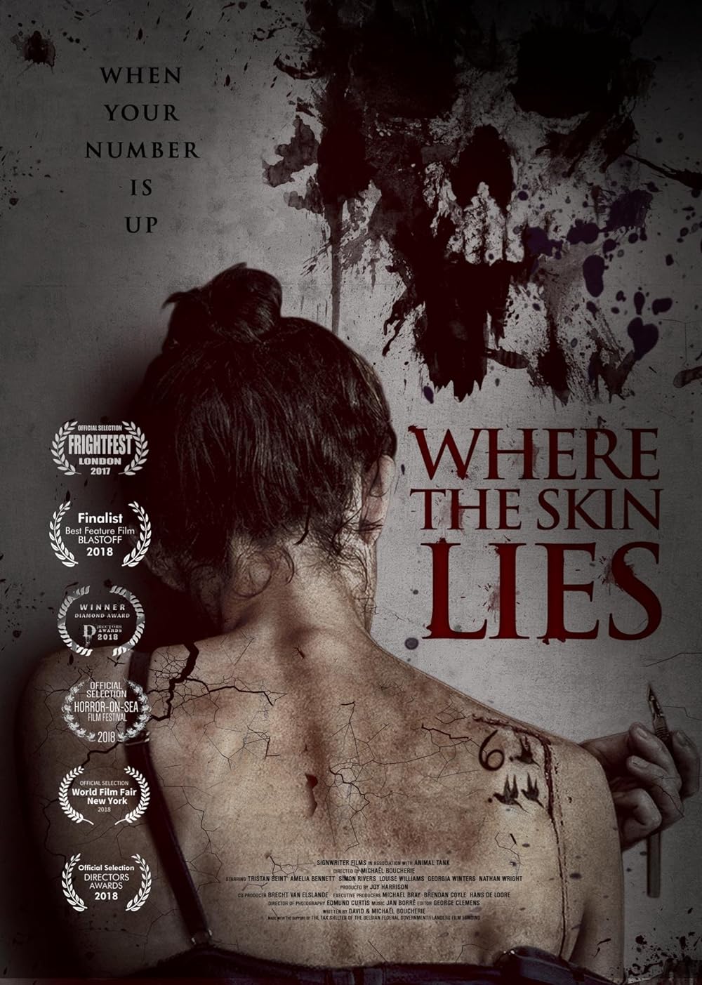 Where the Skin Lies 