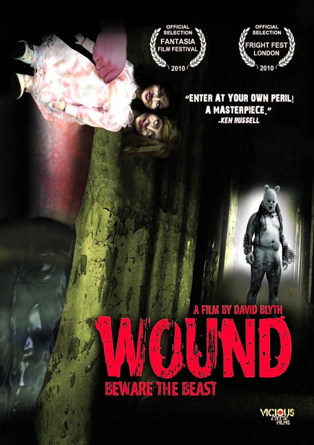 Wound 